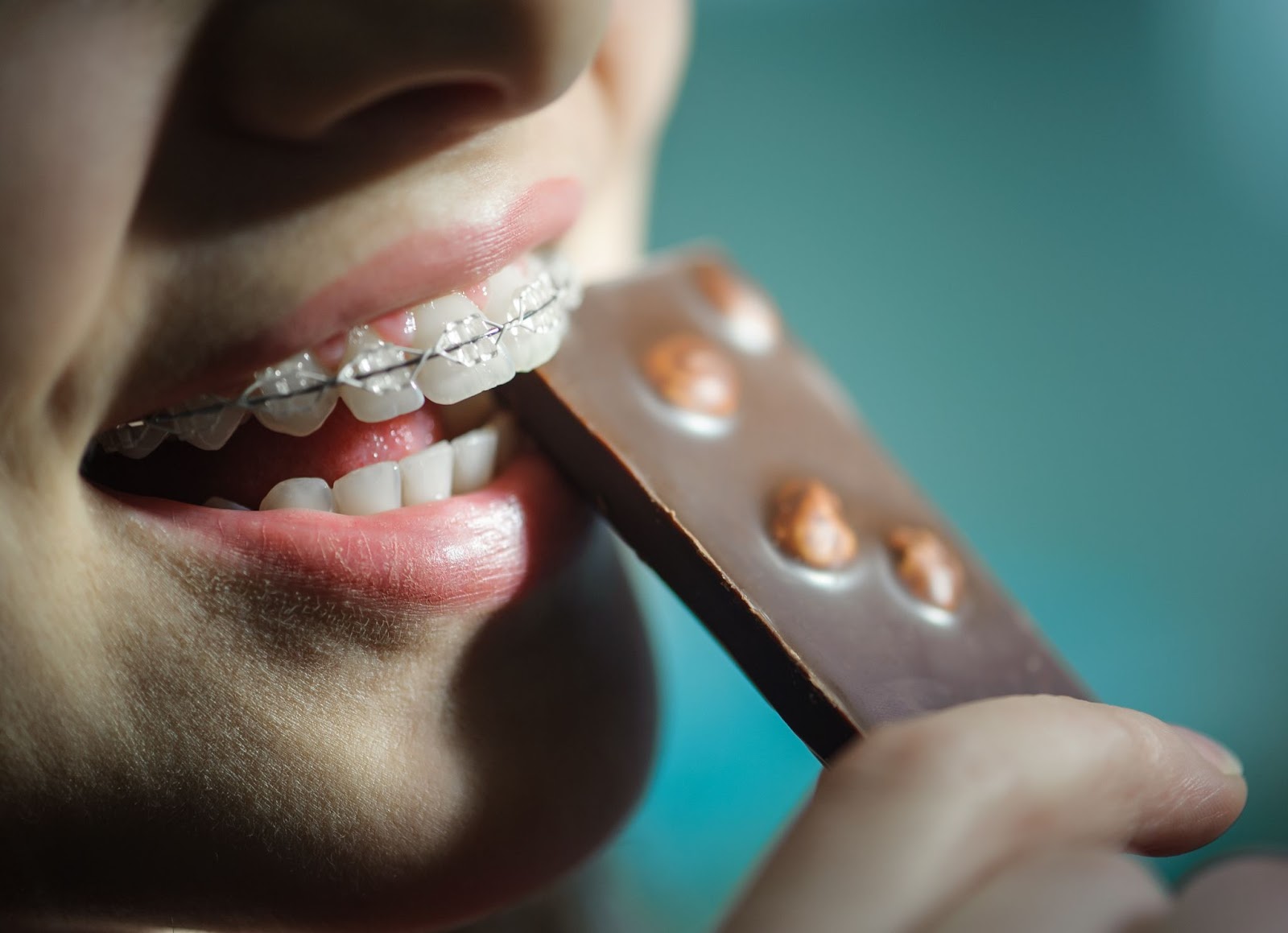 5 foods to avoid with braces