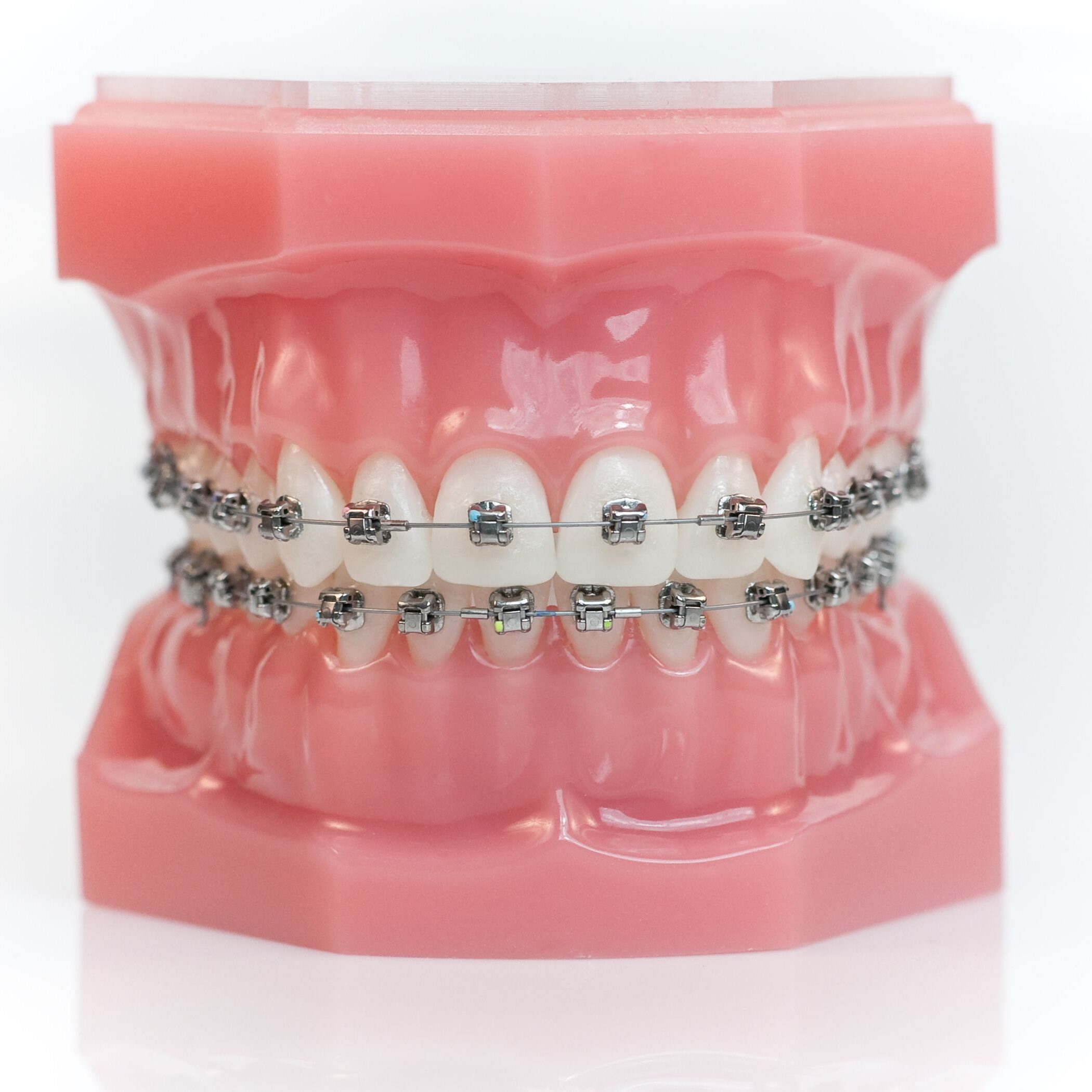 lansdale orthodontist